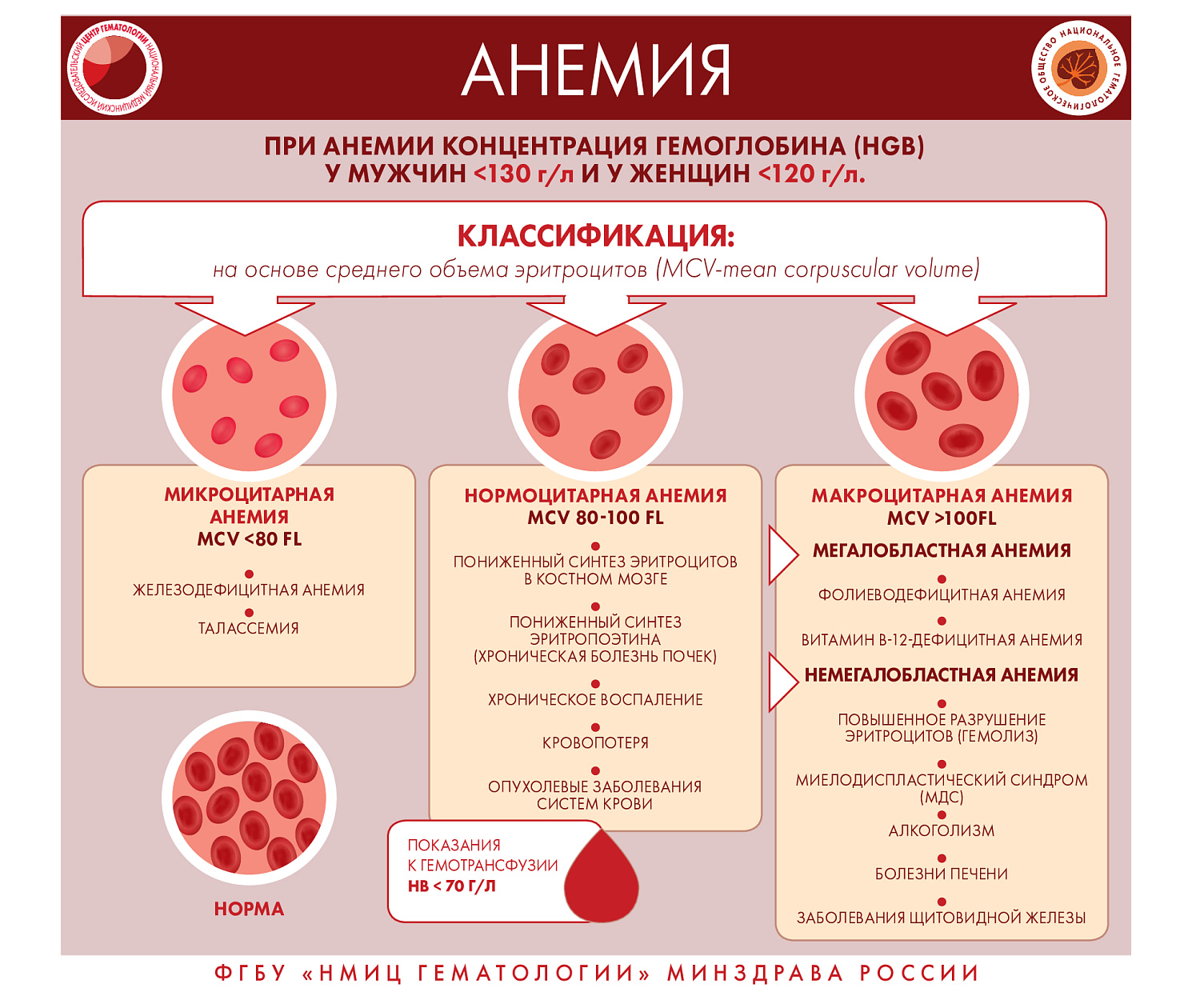 Анемия - диагностика, симптомы, анализы, лечение в СЗЦДМ